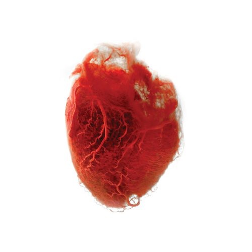 Akron/Family: Love Is Simple [VINYL]