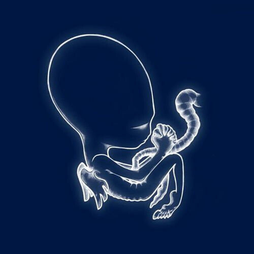 Sigur Ros: Agaetis Byrjun [VINYL]